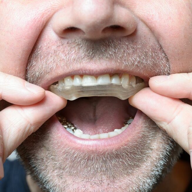 Symptoms Of Teeth Grinding Symptoms Of Teeth Grinding